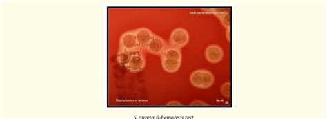 s aureus beta hemolytic|Characterization of hemolysins of Staphylococcus strains isolated .